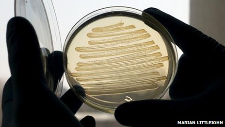 E coli's maken diesel (foto BBC)