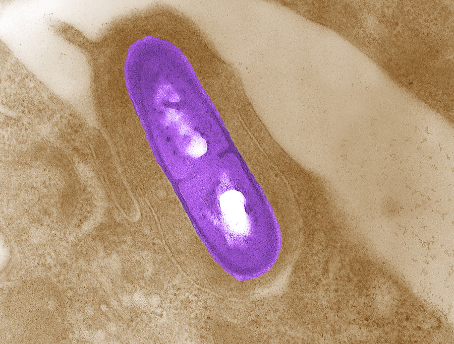 Listeria-bacterie blijkt kankerceldoder (foto bdw)