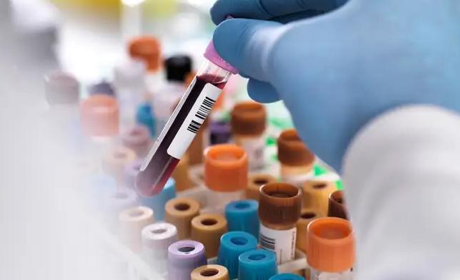Bloedlab