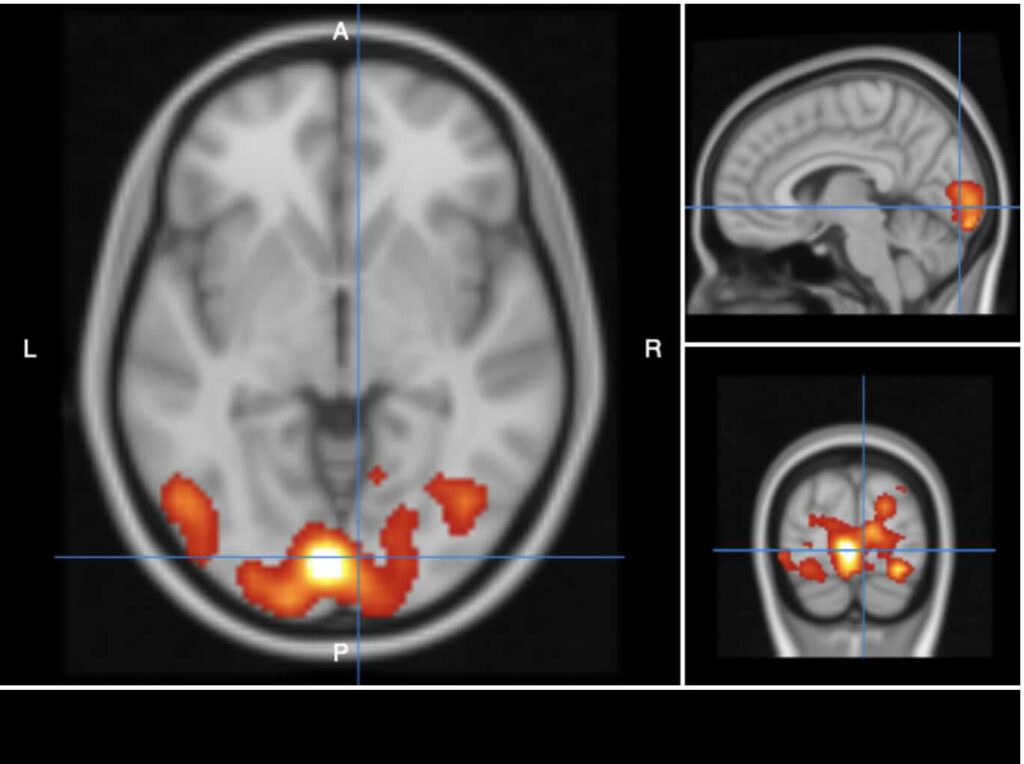 Hersenbeeld van de visuele cortex