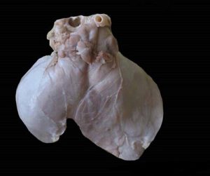 Zwezerik van een mens